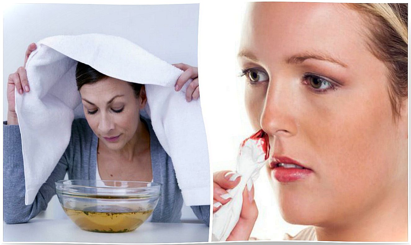 7 effective home remedies for nosebleeds