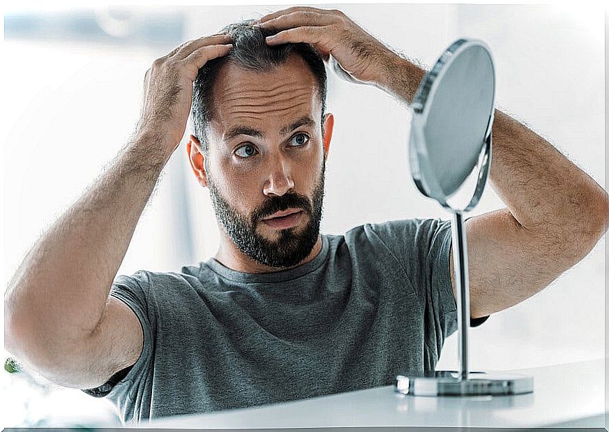 Androgenic alopecia: symptoms, causes and treatment