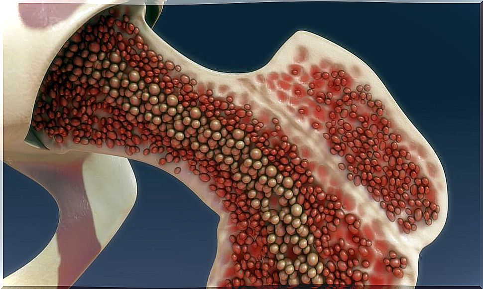 Intraosseous infusion, image of the inside of a bone