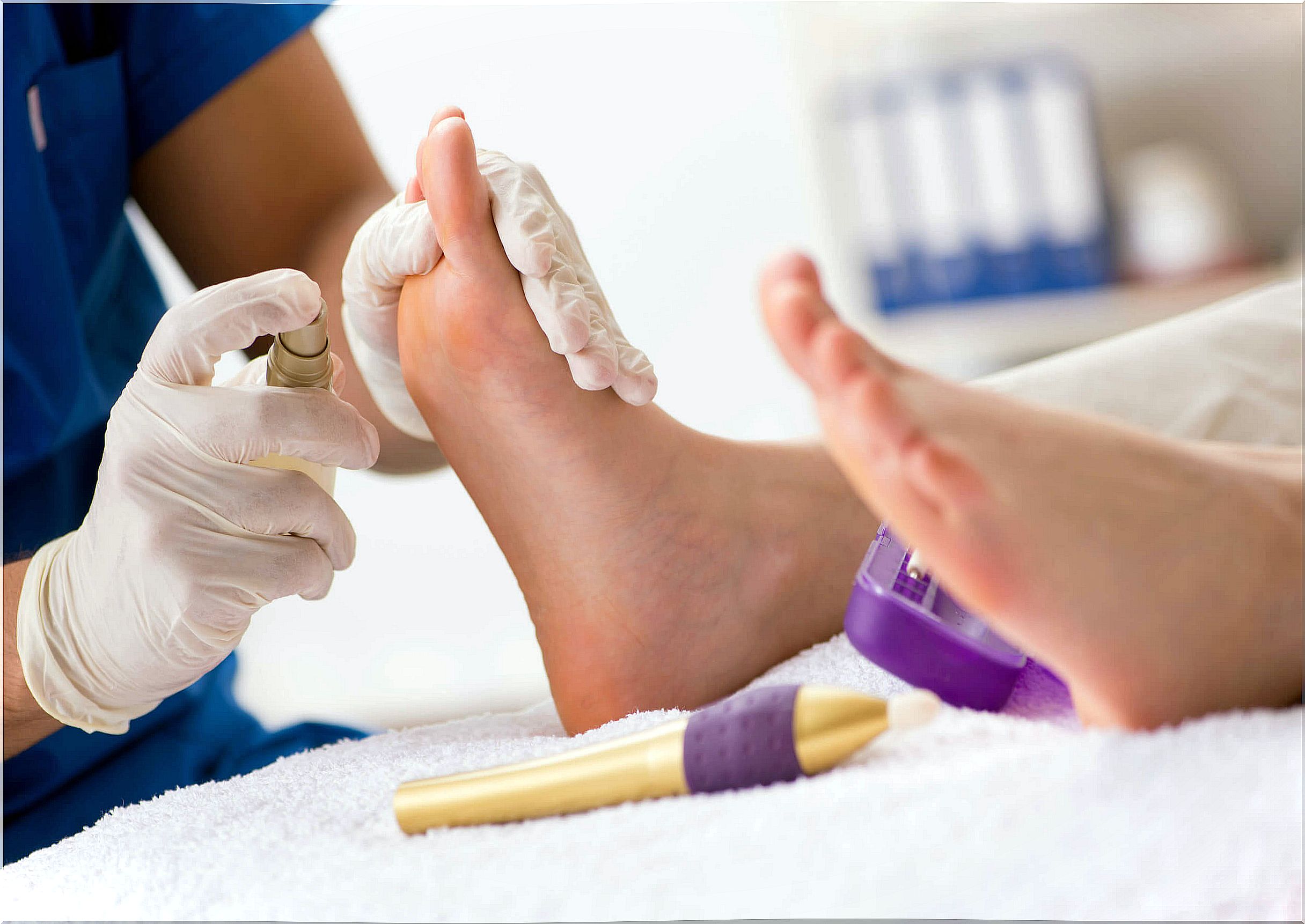 Treatment for onychomycosis is usually lengthy.