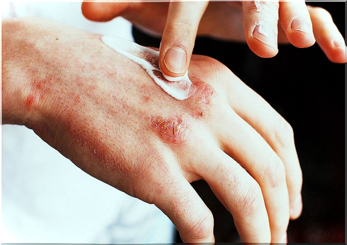 Guidelines for caring for a skin rash