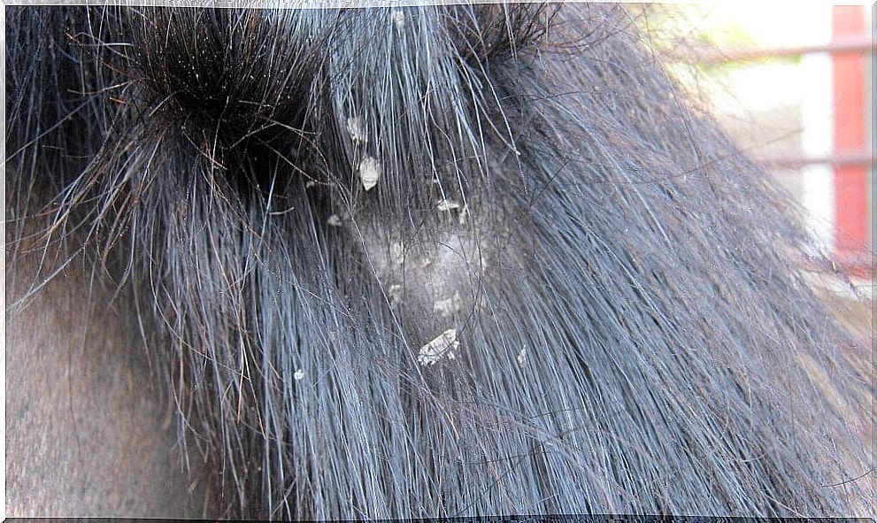 dry or oily dandruff