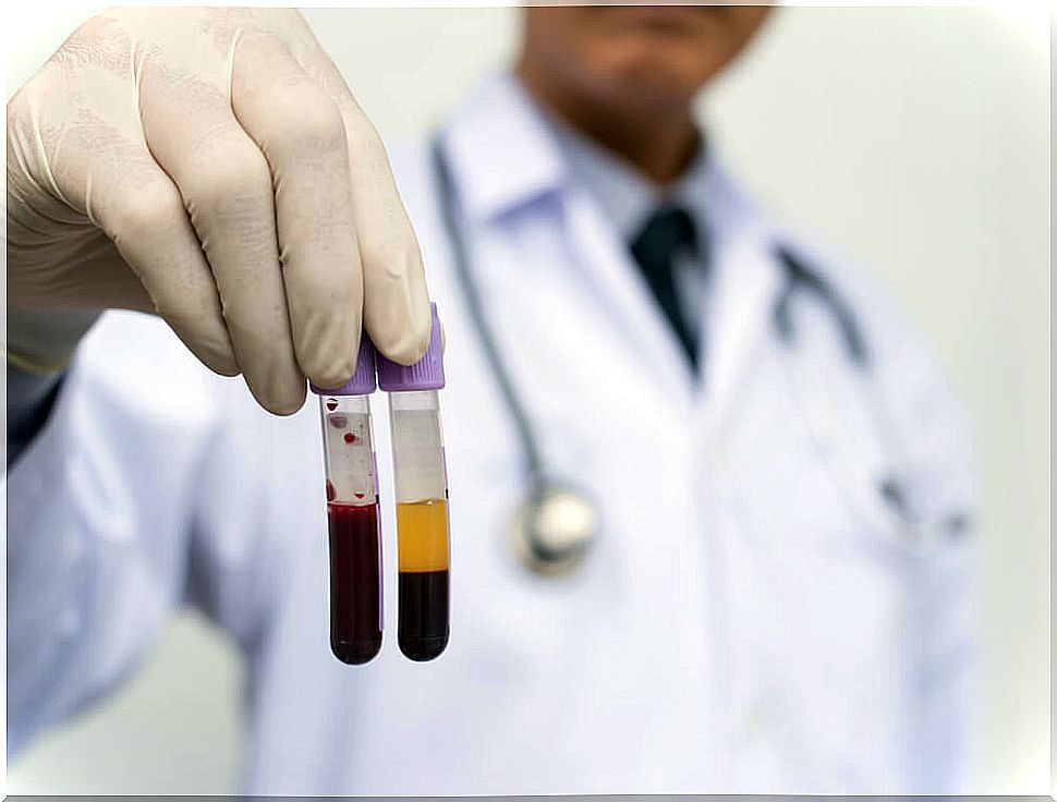 Difference between serum and blood plasma